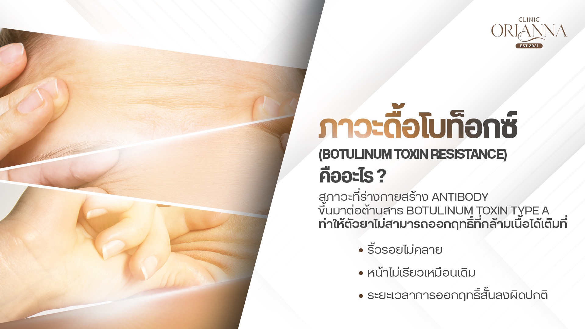 แนวทางการป้องกัน